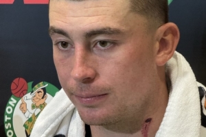 颈部有明显血痕！普理查德：训练营里的对抗像打仗一样